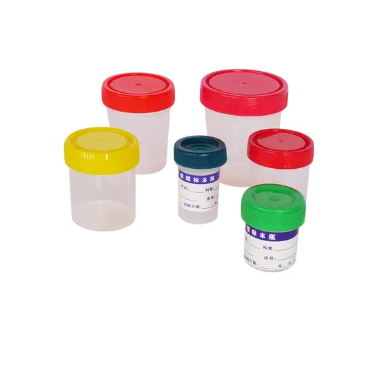 PRECIO DE LABORATOR DE LA ALTA CALIDAD OEM PRECIO DEL PRECIO DE LA HEMATOLOGÍA DEL CONTAJE DE LA PETRIMA DE PETRI